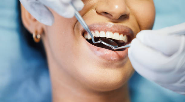 Best Emergency Treatment for Dental Infections or Abscesses in Lincoln Heights, OH