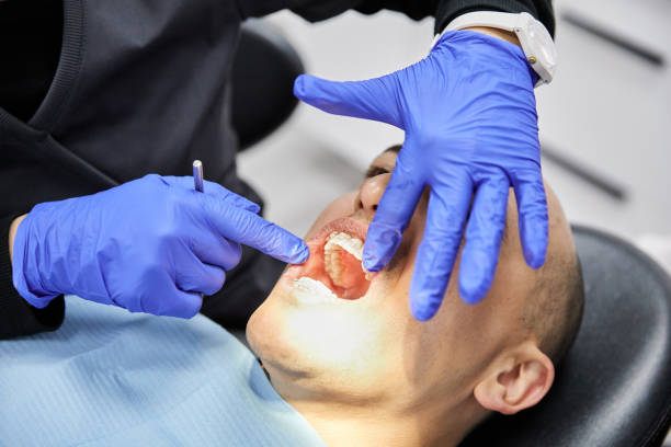 Best Emergency Treatment for Dental Infections or Abscesses in Lincoln Heights, OH